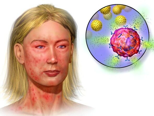 equinococos e sintomas de sua presença no corpo