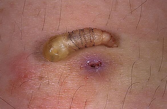 larva parasita subcutânea de humanos
