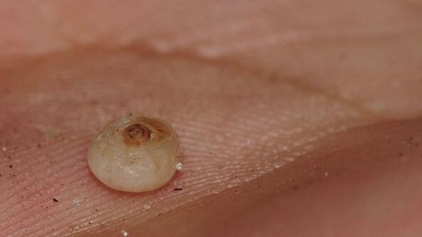 sarcopsilose com parasitas subcutâneos